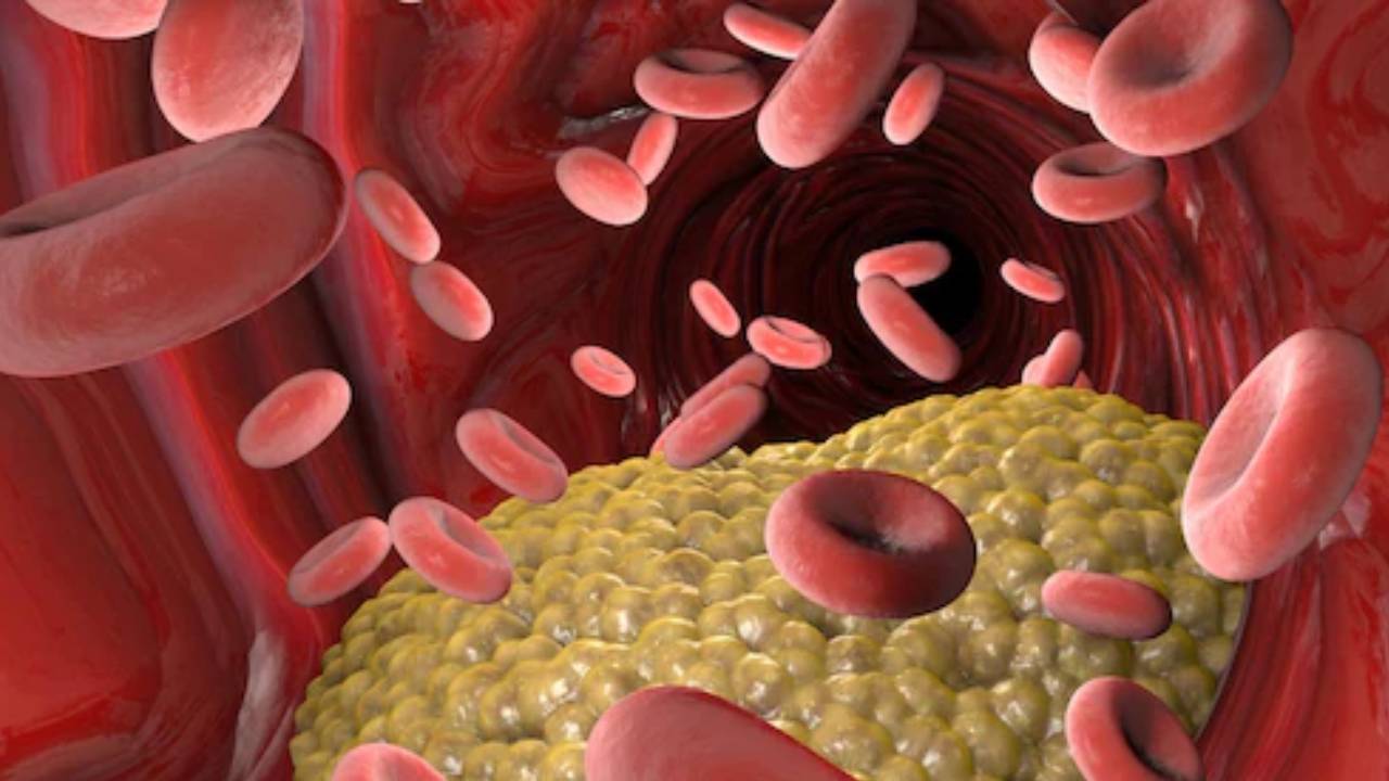 ​किचन में रखी ये चीजें करेगी कोलेस्ट्रॉल कम, आज ही करें इनका सेवन