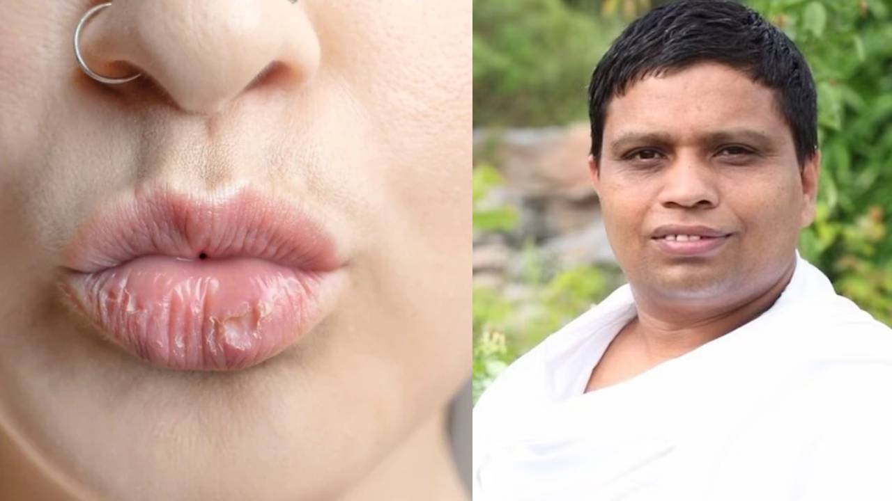 ​सर्दियों में फटे होंठों की समस्या को खत्म करेगा आचार्य बालकृष्ण का ये उपाय