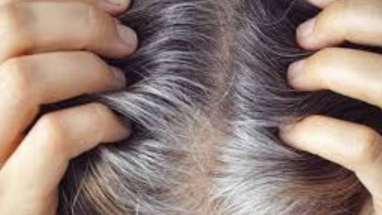 ​बालों को सफेद नहीं होने देंगे ये तेल, रेगुलर इस्तेमाल से जड़े होगी मजबूत