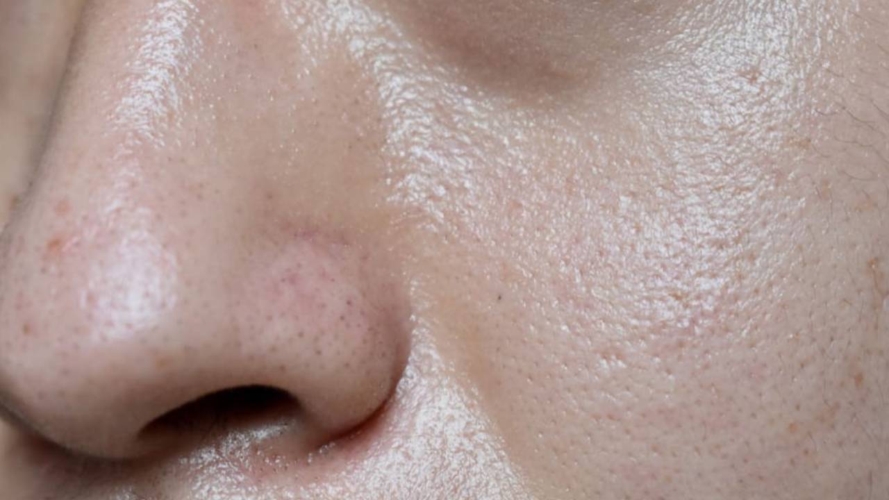 ​ऑयली स्किन से छूटकारा दिलाएंगे ये असरदार टिप्स, फ्रेश दिखेगा चेहरा